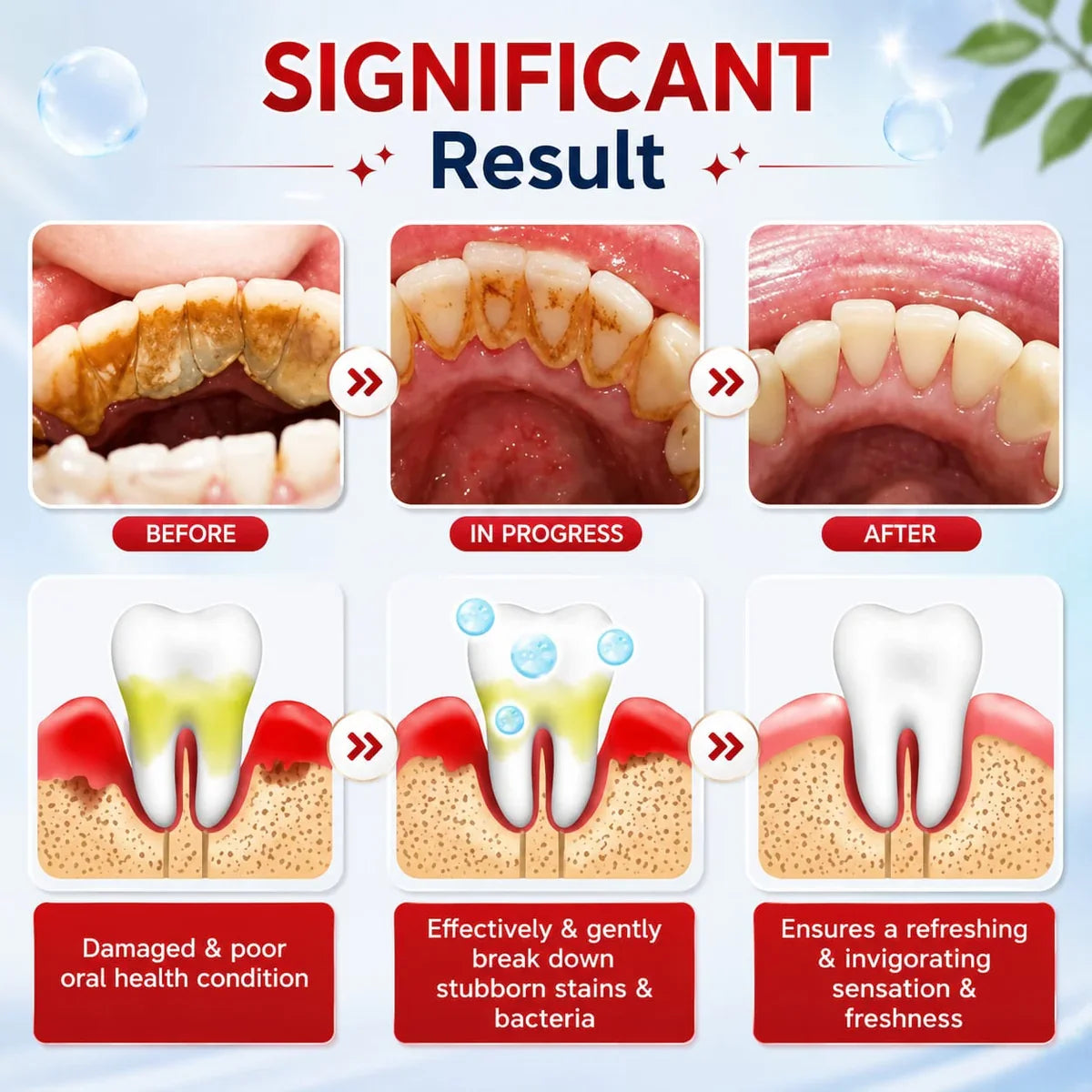 🔥 SP-4 Probiotic Whitening Toothpaste | Deep Clean, Brighten & Freshen | Buy 1 Get 1 FREE!